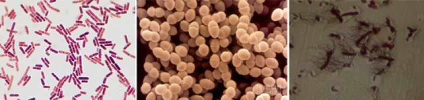 Escherichia sticks, fäkale Enterococcus und Pro – die Haupterreger der chronischen bakteriellen Prostatitis